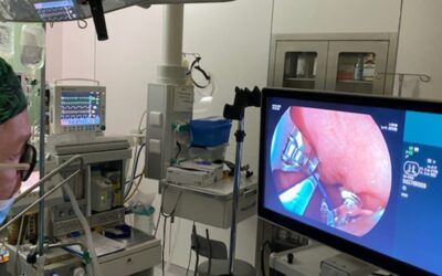 Zabiegi endoskopowej gastroplastyki w&nbsp;Brzezinach