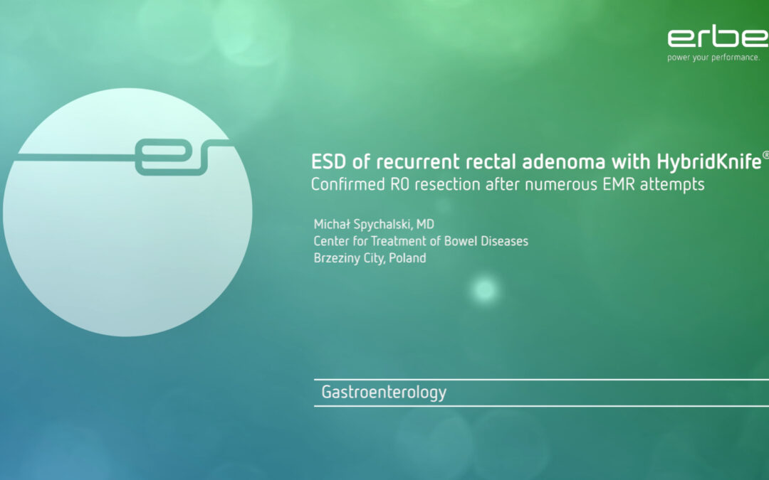 ESD z&nbsp;Brzezin na światowej stronie ERBE