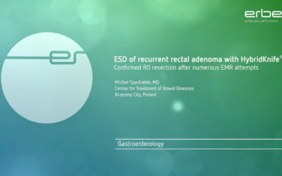 ESD z&nbsp;Brzezin na światowej stronie ERBE