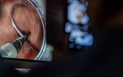 Nowa publikacja w&nbsp;Clinical Endoscopy